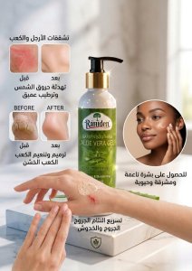 جل الصبار المهدئ والمرطب للبشرة رازيدن (Raziden Soothing Aloe Vera Gel) - 150مل